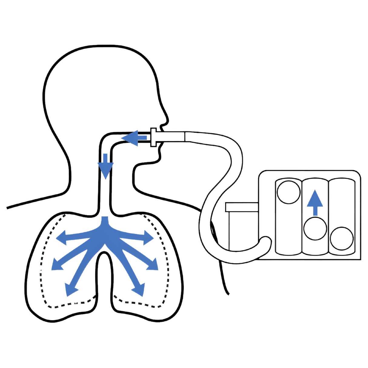 Easyflow Triflo-Solunum Egzersiz Cihazı- 3lü Üfleme Topu (Nefes Egzersiz Topu) - Görsel 2